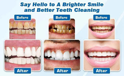 Electric Sonic Teeth Cleaner with Toothbrush Head